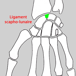 ligaments du poignet - 29&nbsp;Ko